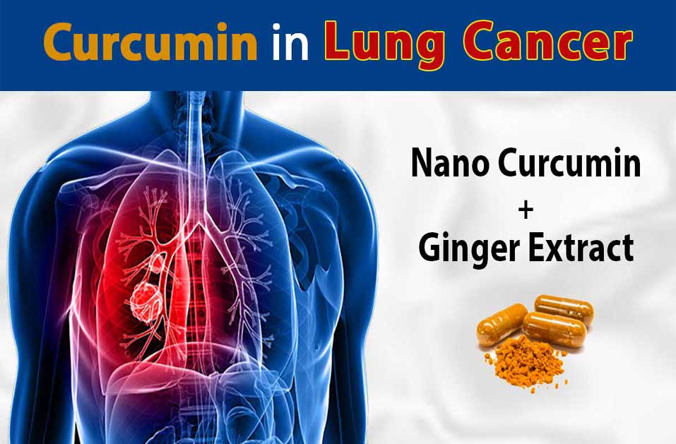 Lung Cancer